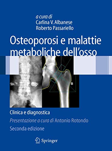 Osteoporosi e malattie metaboliche dell'osso: Clinica e diagnostica